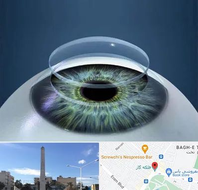 پیوند قرنیه در فلکه گاز شیراز