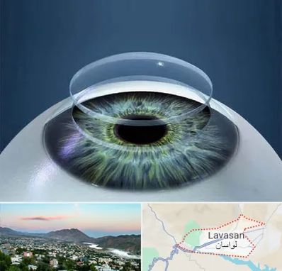 پیوند قرنیه در لواسان