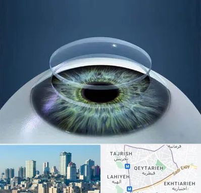 پیوند قرنیه در قیطریه 