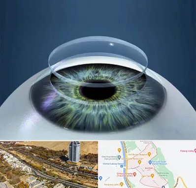 پیوند قرنیه در خیابان نیایش شیراز