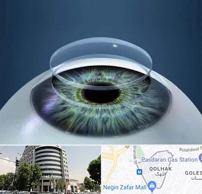 پیوند قرنیه در قلهک 