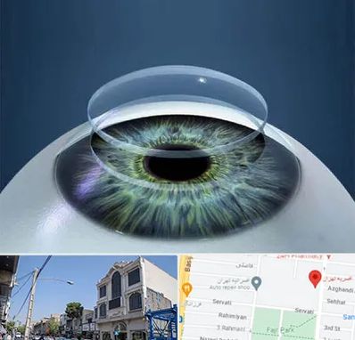 پیوند قرنیه در افسریه 