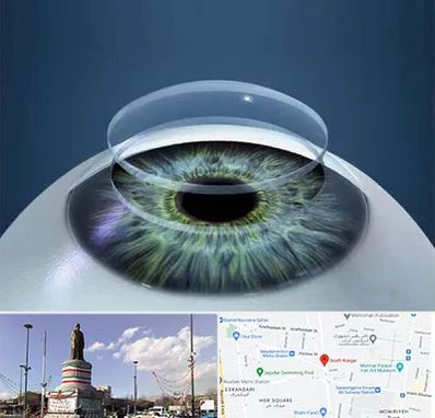 پیوند قرنیه در کارگر جنوبی 