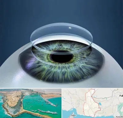 پیوند قرنیه در سیستان و بلوچستان
