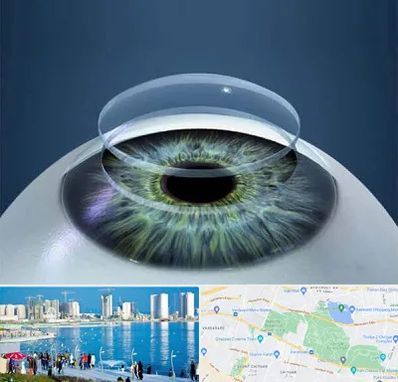 پیوند قرنیه در چیتگر 