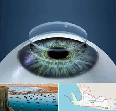 پیوند قرنیه در چابهار