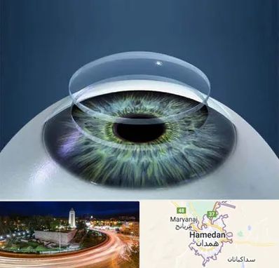 پیوند قرنیه در همدان