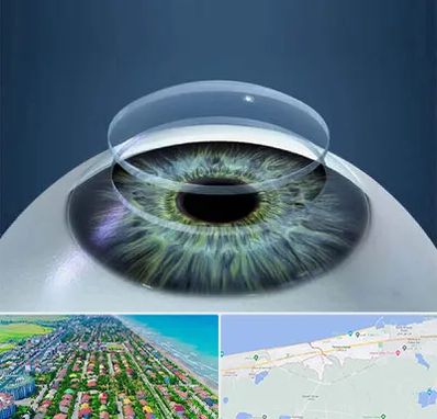 پیوند قرنیه در فریدونکنار