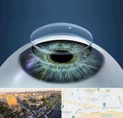 پیوند قرنیه در تهرانپارس 