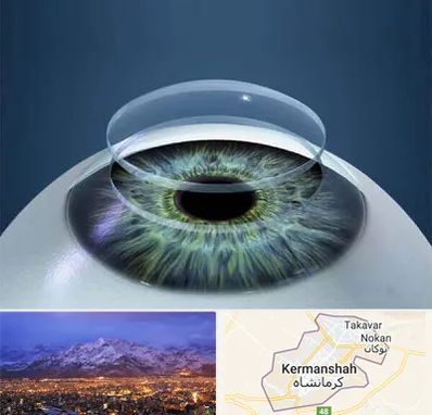 پیوند قرنیه در کرمانشاه