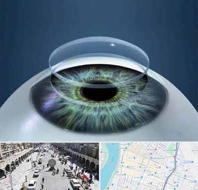 پیوند قرنیه در نادری اهواز