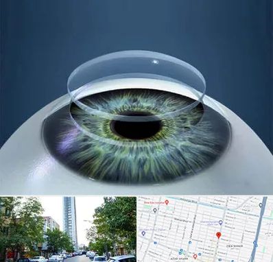 پیوند قرنیه در امامت مشهد