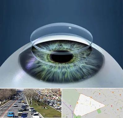 پیوند قرنیه در احمدآباد مشهد 