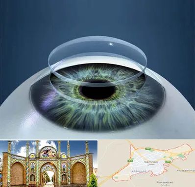 پیوند قرنیه در سمنان