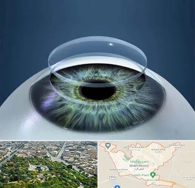 پیوند قرنیه در شهرکرد