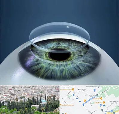 پیوند قرنیه در محلاتی شیراز