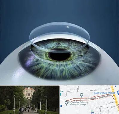 پیوند قرنیه در بلوار معلم رشت 