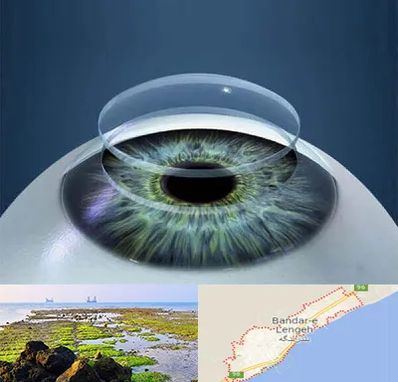 پیوند قرنیه در بندرلنگه