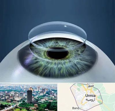 پیوند قرنیه در ارومیه