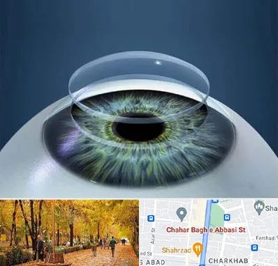 پیوند قرنیه در چهارباغ اصفهان