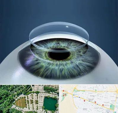 پیوند قرنیه در وکیل آباد مشهد 