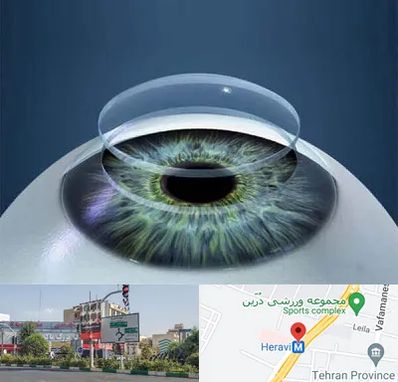 پیوند قرنیه در هروی 