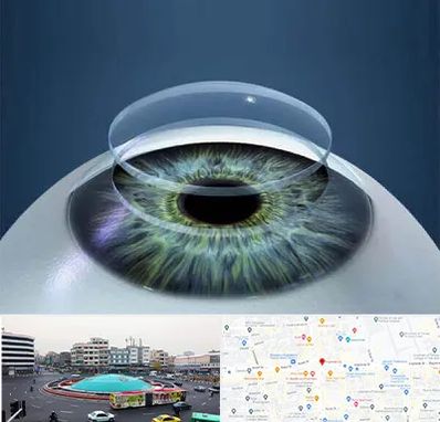 پیوند قرنیه در میدان انقلاب 