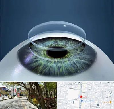 پیوند قرنیه در خیابان توحید اصفهان