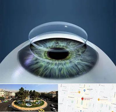 پیوند قرنیه در هفت حوض 