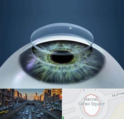 پیوند قرنیه در نواب