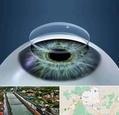 پیوند قرنیه در مراغه