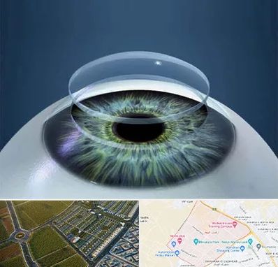 پیوند قرنیه در الهیه مشهد