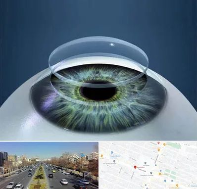 پیوند قرنیه در بلوار معلم مشهد 