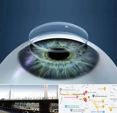 پیوند قرنیه در پارک وی 