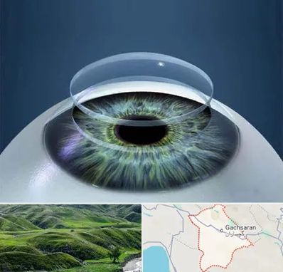 پیوند قرنیه در گچساران