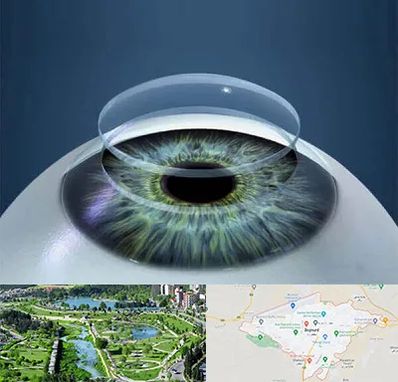 پیوند قرنیه در بجنورد