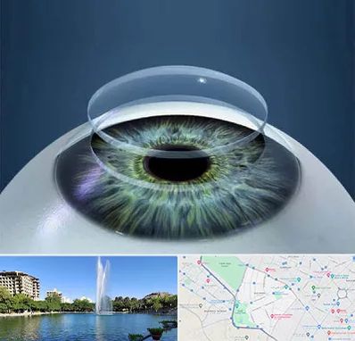 پیوند قرنیه در کوهسنگی مشهد