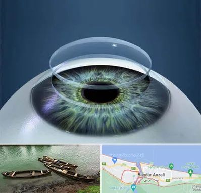 پیوند قرنیه در بندر انزلی