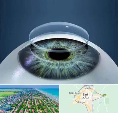 پیوند قرنیه در ساری