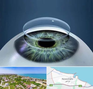 پیوند قرنیه در نوشهر