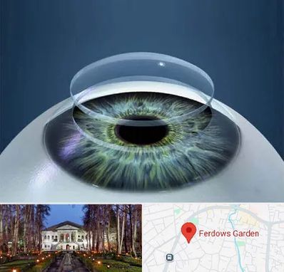 پیوند قرنیه در باغ فردوس