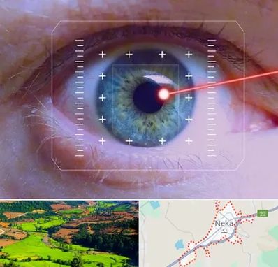 فمتولیزیک در نکا