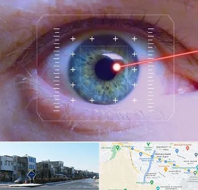 فمتولیزیک در شریعتی مشهد