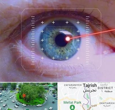 فمتولیزیک در تجریش 