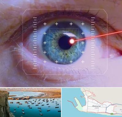 فمتولیزیک در چابهار