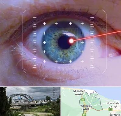 فمتولیزیک در چالوس