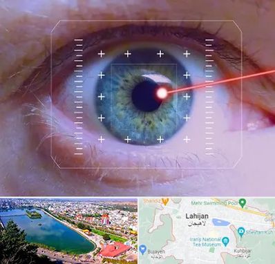 فمتولیزیک در لاهیجان