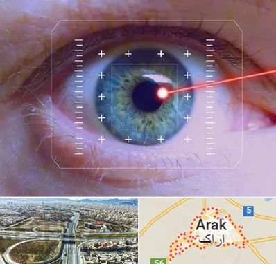 فمتولیزیک در اراک