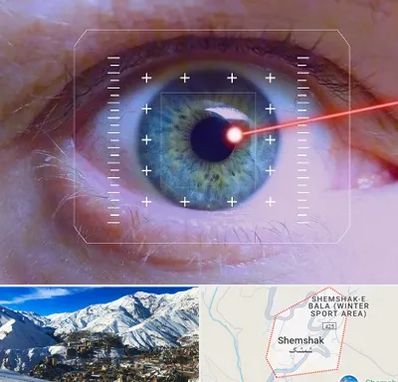 فمتولیزیک در شمشک