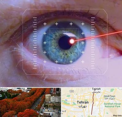 فمتولیزیک در ولیعصر 